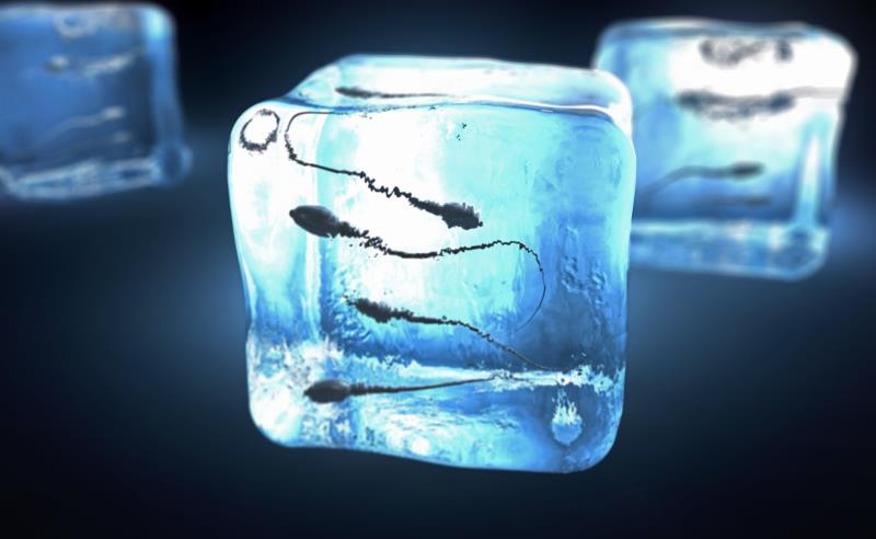 Sperm Cryopreservation